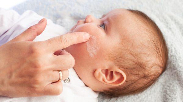 Eczemă la sugari și copii mici – Cauze, simptome și tratament